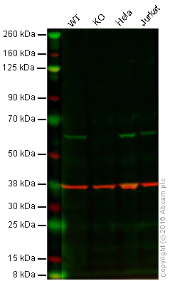 Western blot - Anti-Catalase antibody [EPR1928Y] (AB76110)