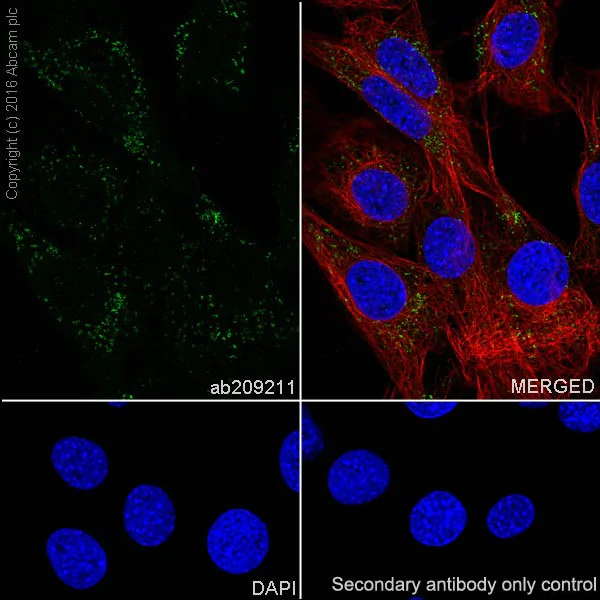 Immunocytochemistry/ Immunofluorescence - Anti-Catalase antibody [EPR20198] - BSA and Azide free (AB223793)