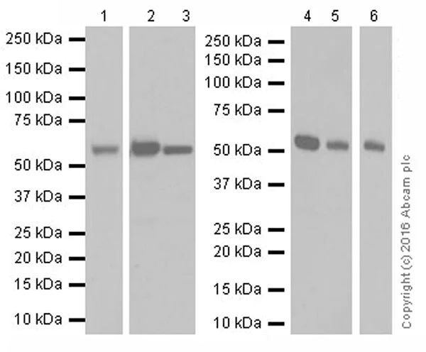 Western blot - Anti-Catalase antibody [EPR20198] - Peroxisome Marker (AB209211)