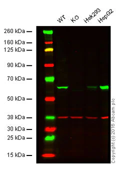 Western blot - Anti-Catalase antibody [EPR20198] - Peroxisome Marker (AB209211)