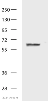 Western blot - Anti-Catalase antibody [EPR20198] - Peroxisome Marker (AB209211)
