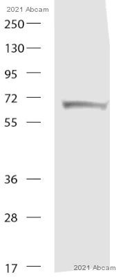 Western blot - Anti-Catalase antibody [EPR20198] - Peroxisome Marker (AB209211)