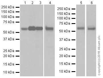 Western blot - Anti-Catalase antibody [EPR20198] - Peroxisome Marker (AB209211)