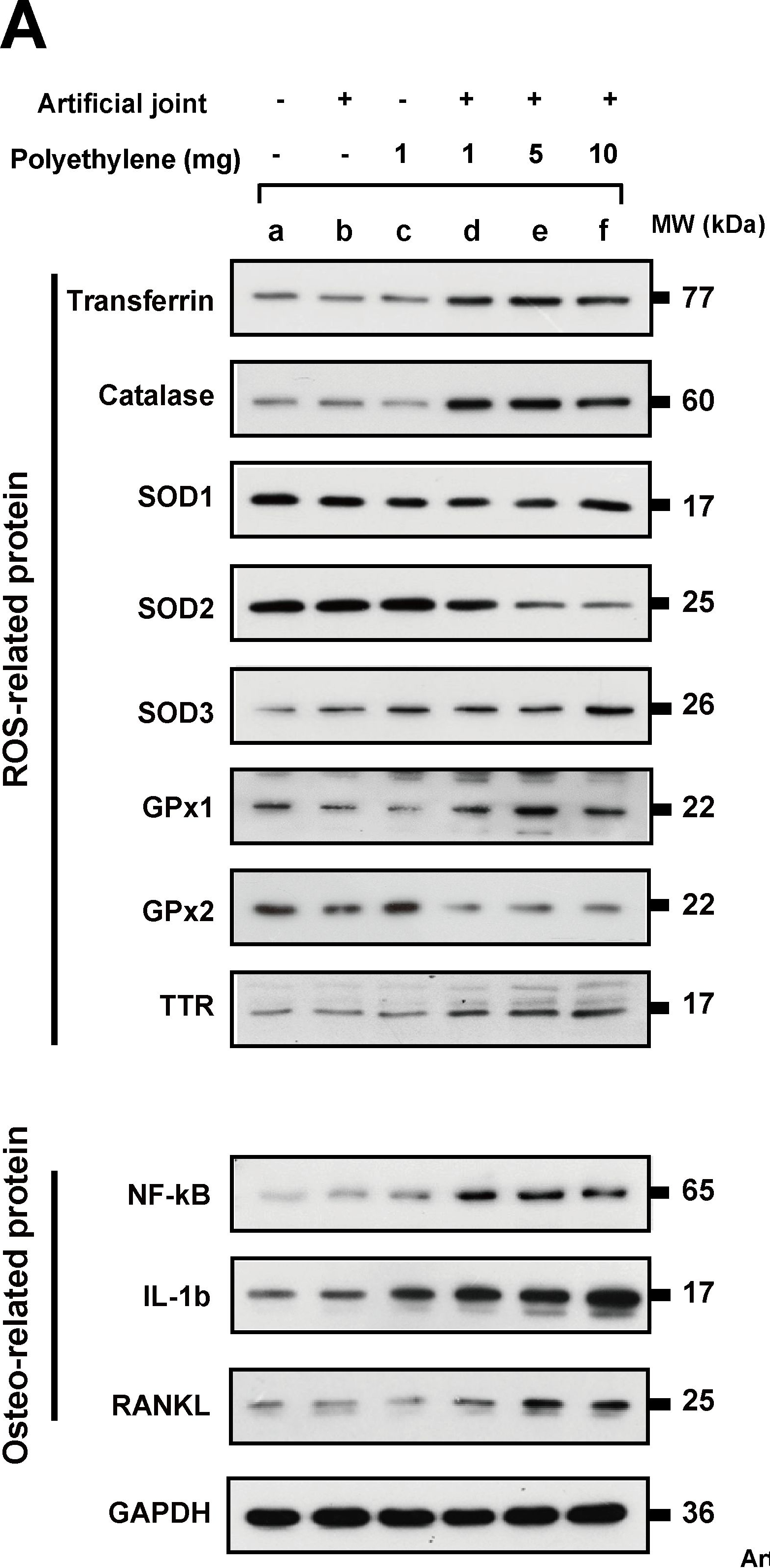 Western blot - Anti-Catalase antibody [EPR20198] - Peroxisome Marker (ab209211), expandable thumbnail