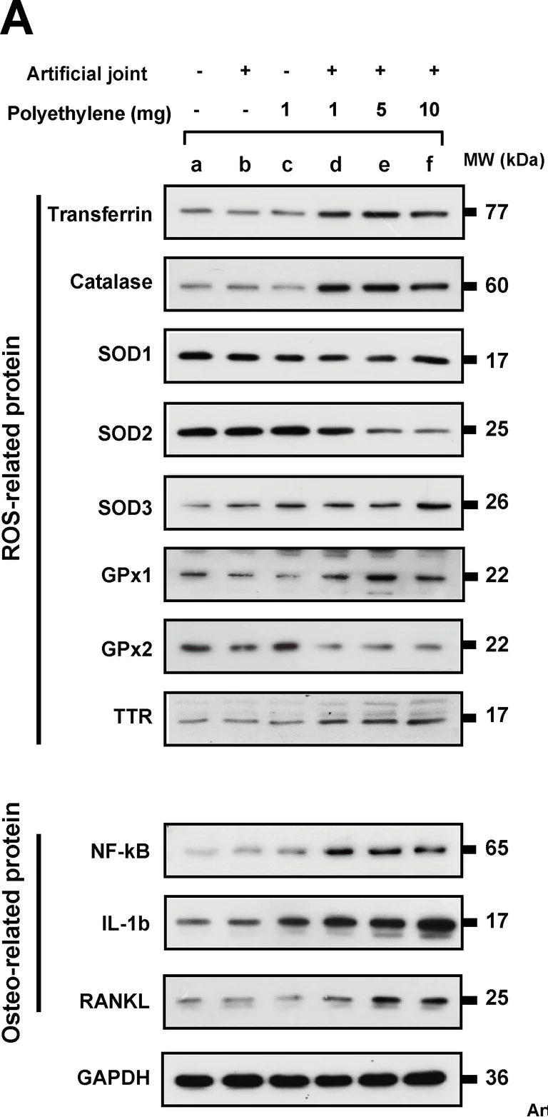 Western blot - Anti-Catalase antibody [EPR20198] - Peroxisome Marker (AB209211)
