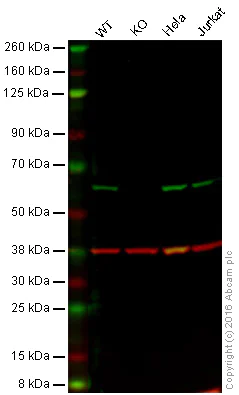 Western blot - Anti-Catalase antibody - Peroxisome Marker (AB52477)