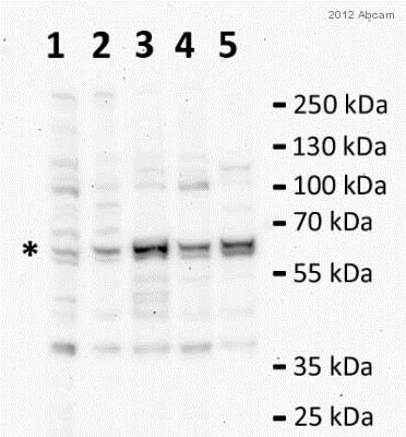 Anti-Catalase antibody - Peroxisome Marker