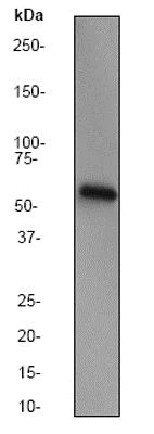 Western blot - Anti-Catalase antibody - Peroxisome Marker (AB52477)