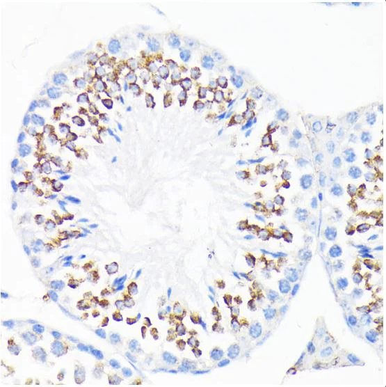 Immunohistochemistry (Formalin/PFA-fixed paraffin-embedded sections) - Anti-Cathelicidin/CLP antibody (AB180760)