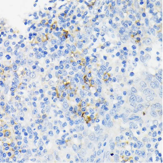 Immunohistochemistry (Formalin/PFA-fixed paraffin-embedded sections) - Anti-Cathelicidin/CLP antibody (AB180760)