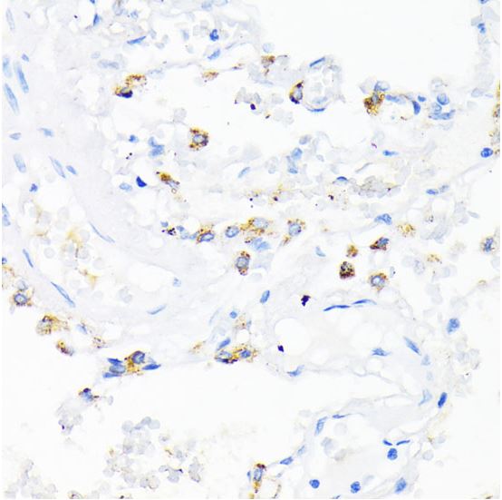 Immunohistochemistry (Formalin/PFA-fixed paraffin-embedded sections) - Anti-Cathelicidin/CLP antibody (AB180760)
