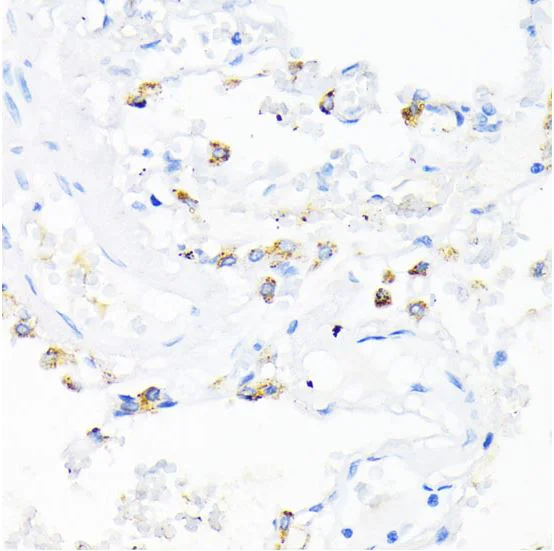 Immunohistochemistry (Formalin/PFA-fixed paraffin-embedded sections) - Anti-Cathelicidin/CLP antibody (AB180760)
