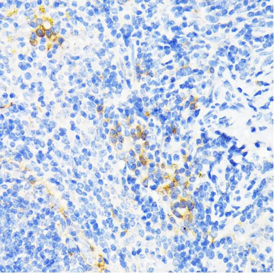 Immunohistochemistry (Formalin/PFA-fixed paraffin-embedded sections) - Anti-Cathelicidin/CLP antibody (AB180760)