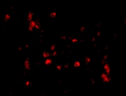 Immunocytochemistry/ Immunofluorescence - Anti-Cathelicidin/CLP antibody (AB69484), expandable thumbnail