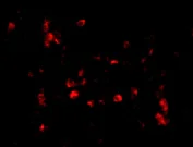 Immunocytochemistry/ Immunofluorescence - Anti-Cathelicidin/CLP antibody (AB69484)