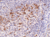 Immunohistochemistry (Formalin/PFA-fixed paraffin-embedded sections) - Anti-Cathelicidin/CLP antibody (AB69484), expandable thumbnail