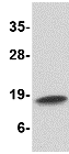 Western blot - Anti-Cathelicidin/CLP antibody (AB69484), expandable thumbnail