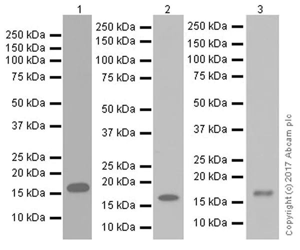 Western blot - Anti-Cathelicidin/CLP antibody [EPR20469] (AB207758)