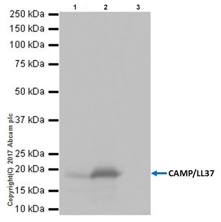 Immunoprecipitation - Anti-Cathelicidin/CLP antibody [EPR20469] - BSA and Azide free (AB240378), expandable thumbnail