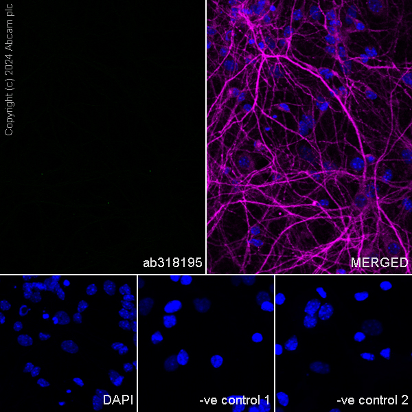 Immunocytochemistry/ Immunofluorescence - Anti-Cathelicidin/CLP antibody [EPR28791-612] (ab318195), expandable thumbnail