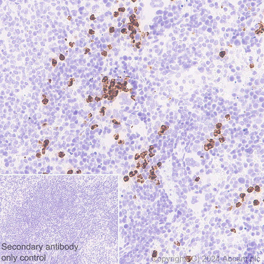 Immunohistochemistry (Formalin/PFA-fixed paraffin-embedded sections) - Anti-Cathelicidin/CLP antibody [EPR28791-612] (ab318195), expandable thumbnail
