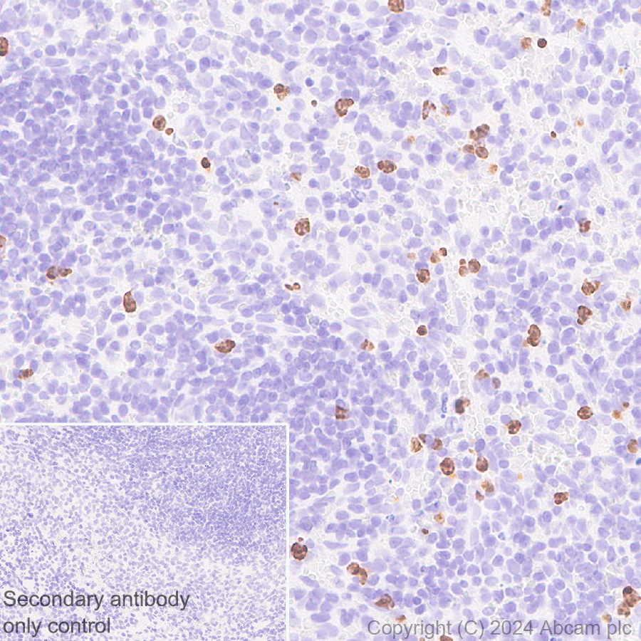 Immunohistochemistry (Formalin/PFA-fixed paraffin-embedded sections) - Anti-Cathelicidin/CLP antibody [EPR28791-612] (ab318195), expandable thumbnail