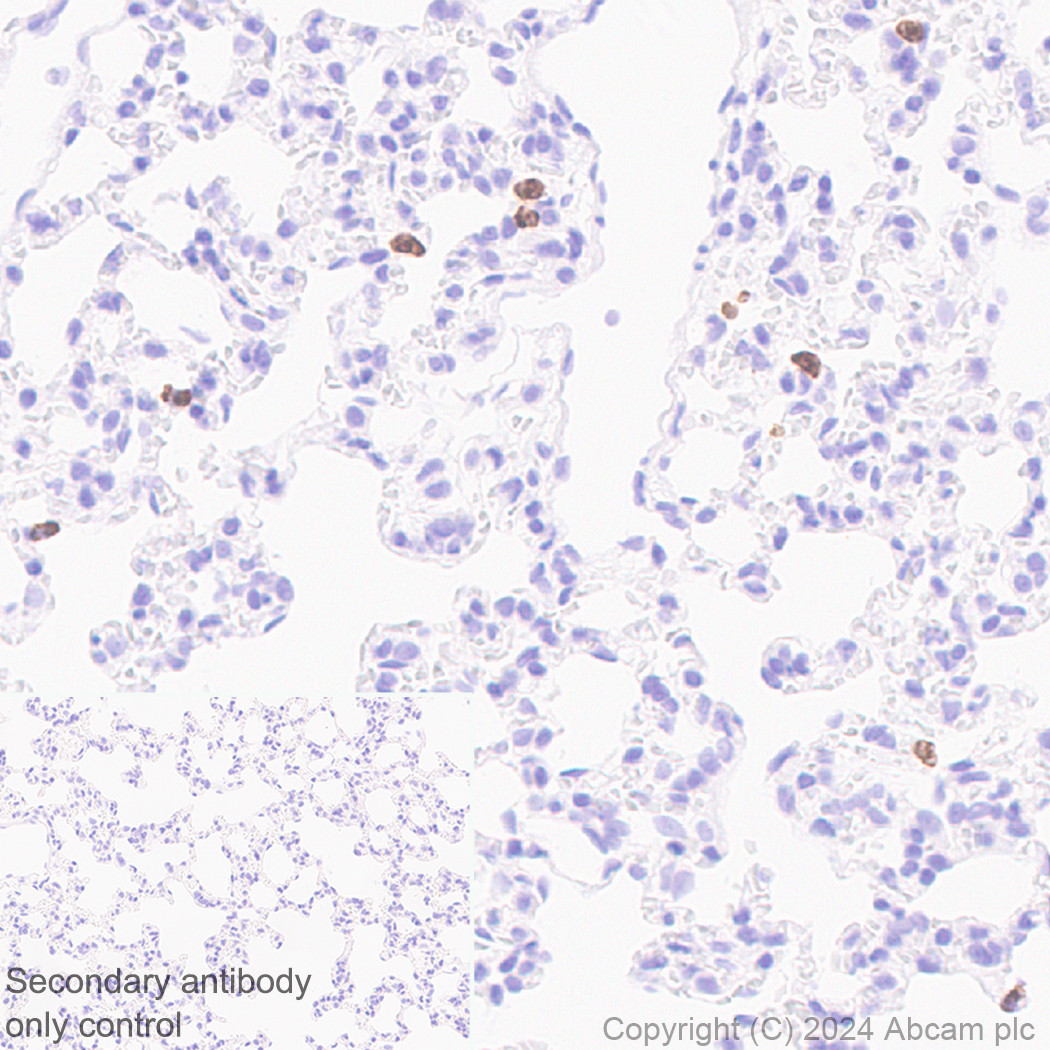 Immunohistochemistry (Formalin/PFA-fixed paraffin-embedded sections) - Anti-Cathelicidin/CLP antibody [EPR28791-612] (ab318195), expandable thumbnail