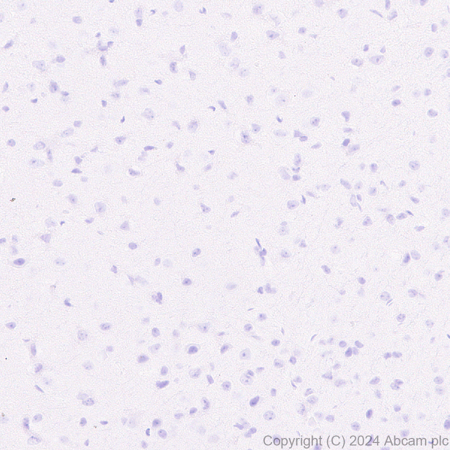 Immunohistochemistry (Formalin/PFA-fixed paraffin-embedded sections) - Anti-Cathelicidin/CLP antibody [EPR28791-612] (ab318195), expandable thumbnail