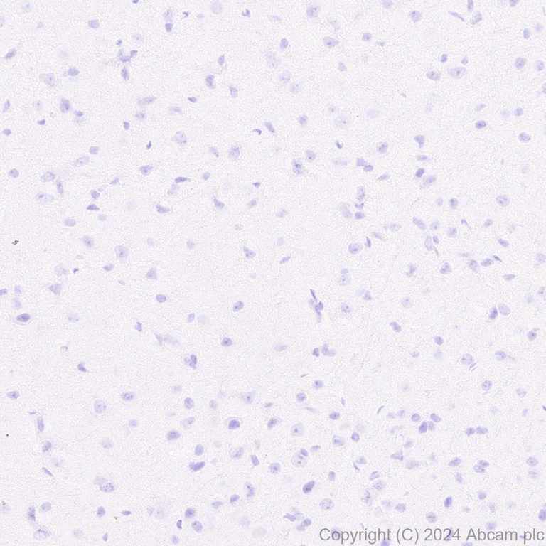 Immunohistochemistry (Formalin/PFA-fixed paraffin-embedded sections) - Anti-Cathelicidin/CLP antibody [EPR28791-612] (AB318195)