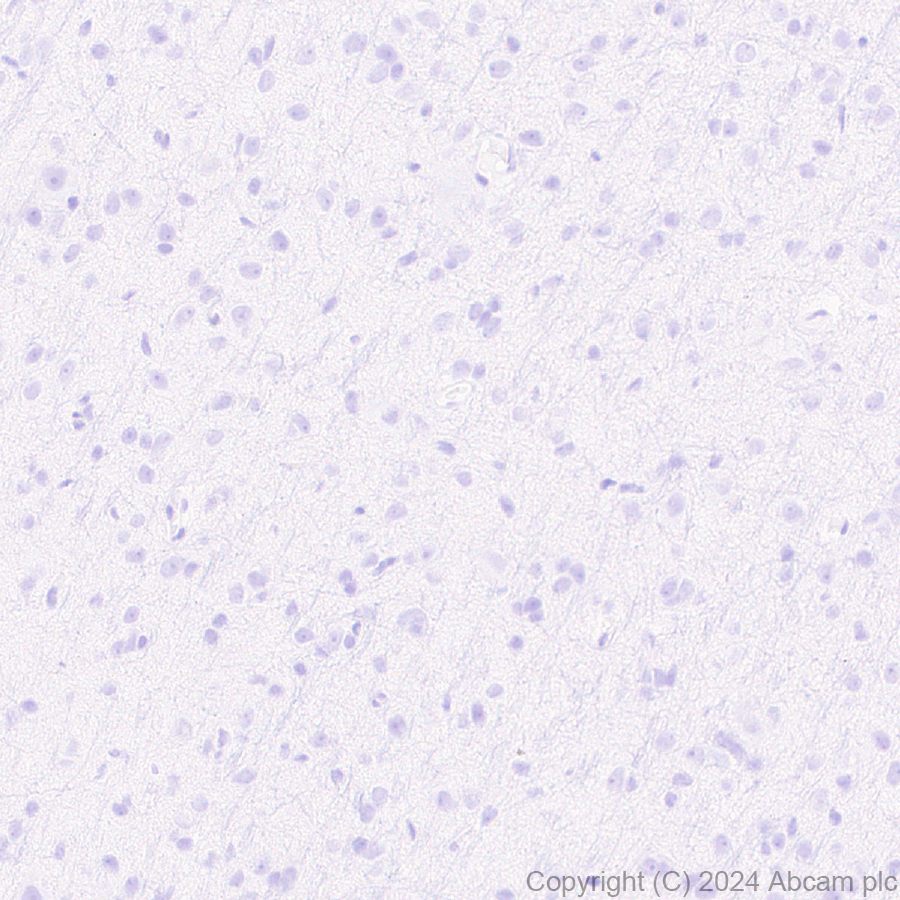 Immunohistochemistry (Formalin/PFA-fixed paraffin-embedded sections) - Anti-Cathelicidin/CLP antibody [EPR28791-612] (AB318195), expandable thumbnail