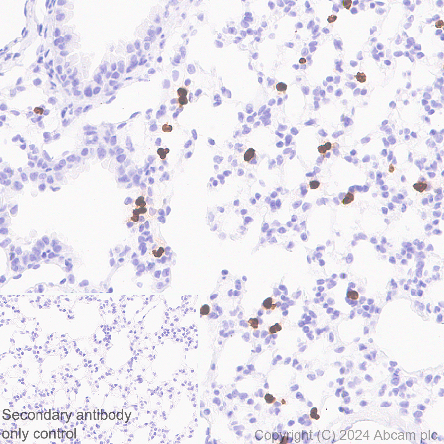 Immunohistochemistry (Formalin/PFA-fixed paraffin-embedded sections) - Anti-Cathelicidin/CLP antibody [EPR28791-612] - BSA and Azide free (ab318196), expandable thumbnail