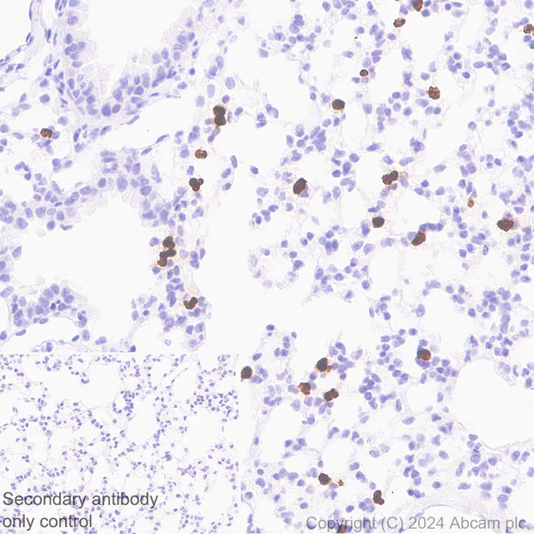 Immunohistochemistry (Formalin/PFA-fixed paraffin-embedded sections) - Anti-Cathelicidin/CLP antibody [EPR28791-612] - BSA and Azide free (AB318196)