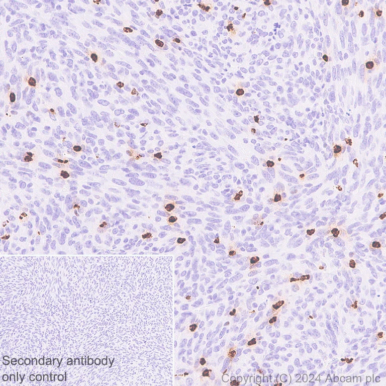 Immunohistochemistry (Formalin/PFA-fixed paraffin-embedded sections) - Anti-Cathelicidin/CLP antibody [EPR28791-612] - BSA and Azide free (AB318196)