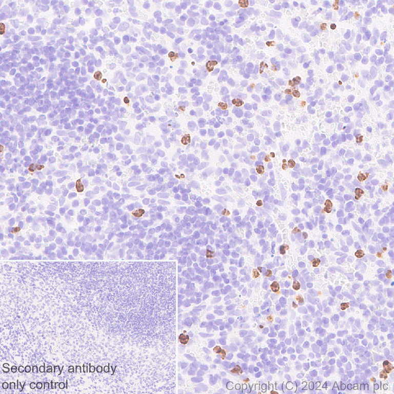 Immunohistochemistry (Formalin/PFA-fixed paraffin-embedded sections) - Anti-Cathelicidin/CLP antibody [EPR28791-612] - BSA and Azide free (AB318196)