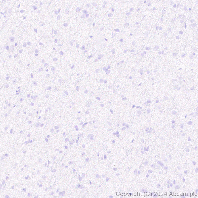 Immunohistochemistry (Formalin/PFA-fixed paraffin-embedded sections) - Anti-Cathelicidin/CLP antibody [EPR28791-612] - BSA and Azide free (AB318196)