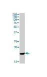 Western blot - Anti-Cathelicidin/CLP antibody [H7] (AB80895)
