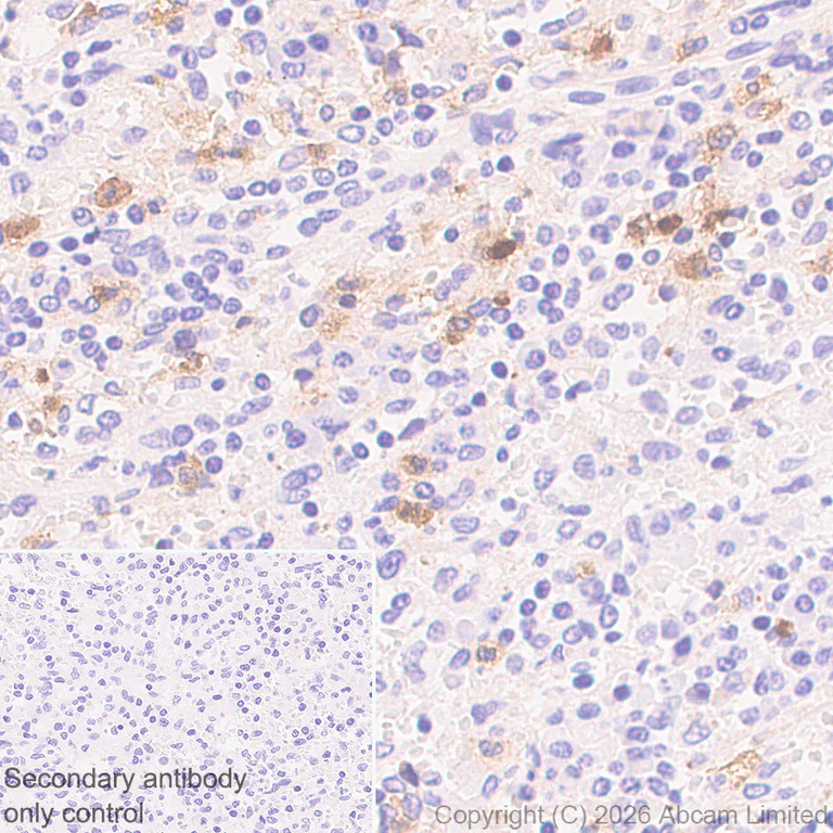 Immunohistochemistry (Formalin/PFA-fixed paraffin-embedded sections) - Anti-Cathelicidin/CLP antibody [RM1363] (AB325356)