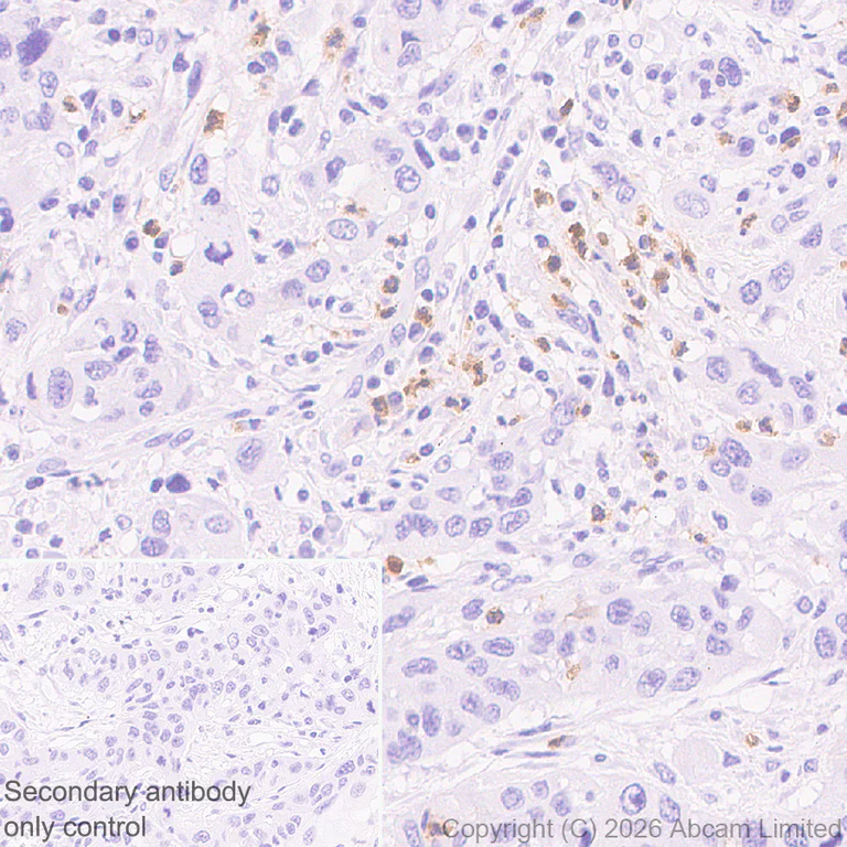 Immunohistochemistry (Formalin/PFA-fixed paraffin-embedded sections) - Anti-Cathelicidin/CLP antibody [RM1363] (AB325356)