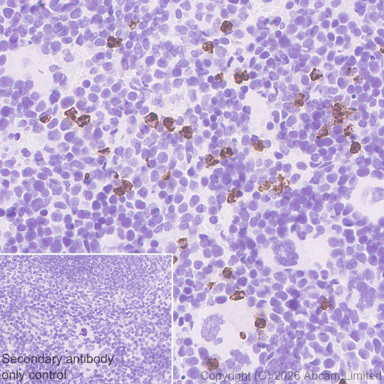 Immunohistochemistry (Formalin/PFA-fixed paraffin-embedded sections) - Anti-Cathelicidin/CLP antibody [RM1363] (AB325356)