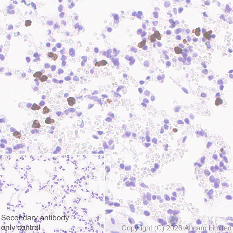 Immunohistochemistry (Formalin/PFA-fixed paraffin-embedded sections) - Anti-Cathelicidin/CLP antibody [RM1363] (AB325356)