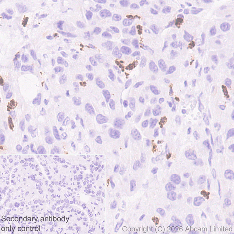 Immunohistochemistry (Formalin/PFA-fixed paraffin-embedded sections) - Anti-Cathelicidin/CLP antibody [RM1363] (AB325356)