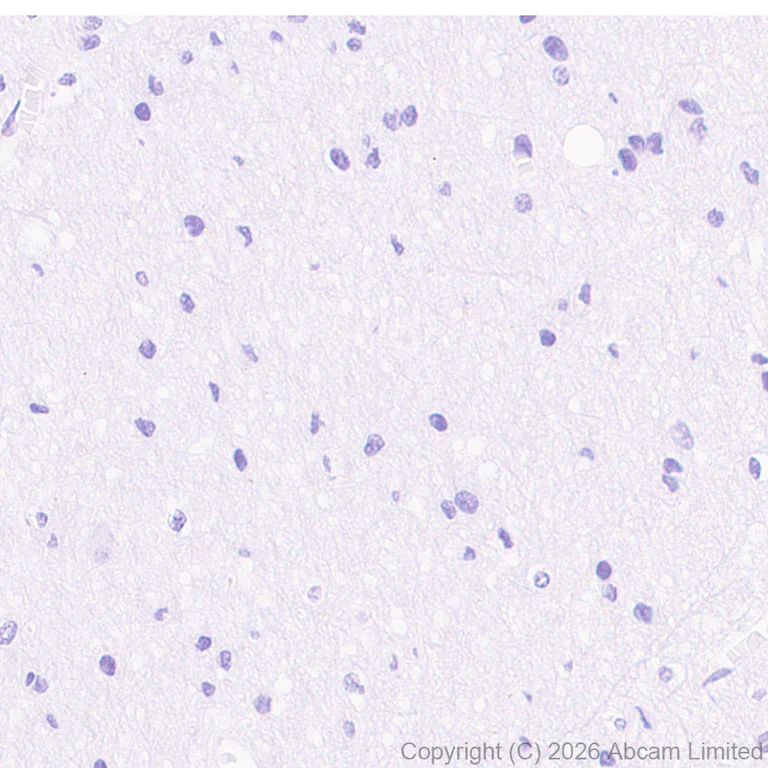 Immunohistochemistry (Formalin/PFA-fixed paraffin-embedded sections) - Anti-Cathelicidin/CLP antibody [RM1363] (AB325356)