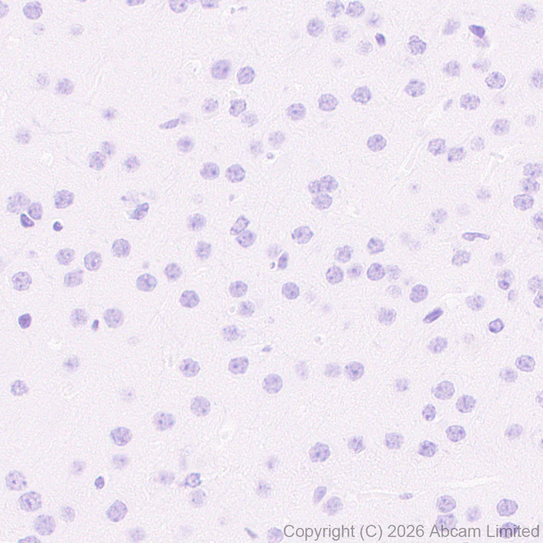 Immunohistochemistry (Formalin/PFA-fixed paraffin-embedded sections) - Anti-Cathelicidin/CLP antibody [RM1363] (AB325356)
