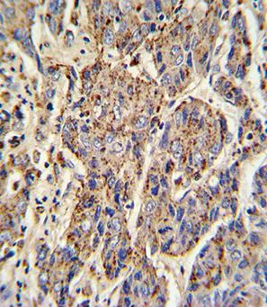 Immunohistochemistry (Formalin/PFA-fixed paraffin-embedded sections) - Anti-Cathepsin B antibody (AB190077)