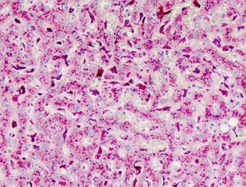 Immunohistochemistry (Formalin/PFA-fixed paraffin-embedded sections) - Anti-Cathepsin B antibody (AB190077)