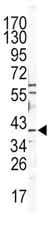 Western blot - Anti-Cathepsin B antibody (AB190077)