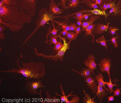 Immunocytochemistry/ Immunofluorescence - Anti-Cathepsin B antibody (AB92955)