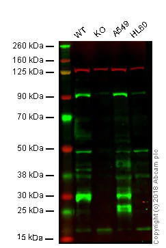 Western blot - Anti-Cathepsin B antibody (AB92955)