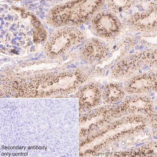 Immunohistochemistry (Formalin/PFA-fixed paraffin-embedded sections) - Anti-Cathepsin B antibody [EPR21033] (AB214428)