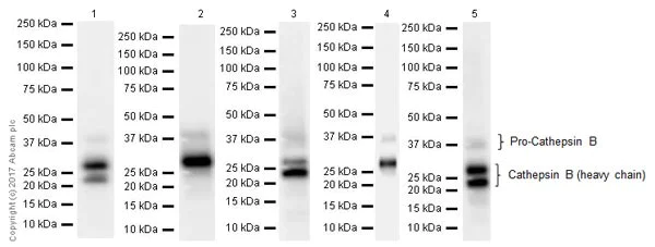 Western blot - Anti-Cathepsin B antibody [EPR21033] (AB214428)